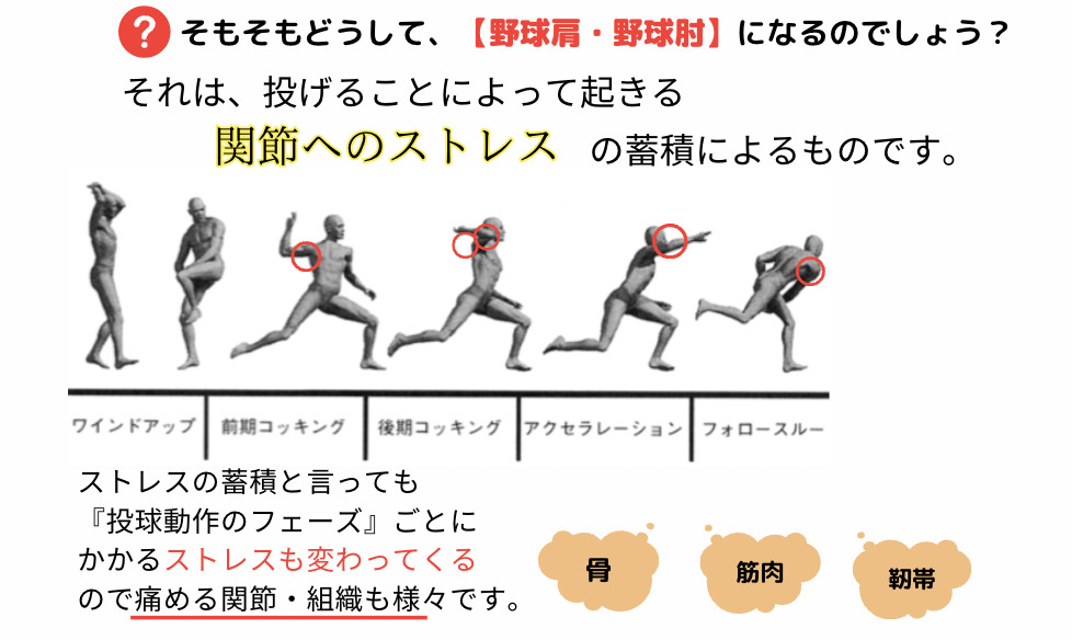 野球肩・野球肘の根本改善を目ざすなら、大阪市の『整体院 友』にお任せください